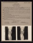 Lower Limb. Surface Anatomy - no. 3